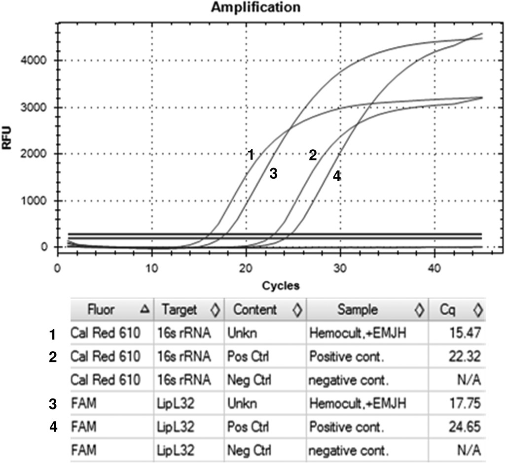 Improvement of the enrichment used in the EMJH medium  (Ellinghausen–McCullough–Johnson–Harris) for the cultivation of Leptospira  spp. - ScienceDirect